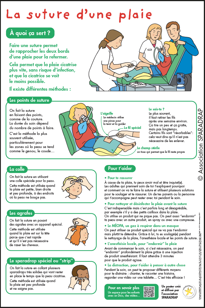 Visuel du poster "La suture d'une plaie"