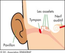 Oreille - zoom 2