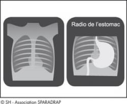 radiographie